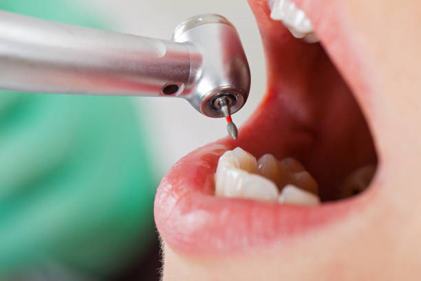 Best Emergency Dentist for Knocked-Out Tooth in Town And Country, MO
